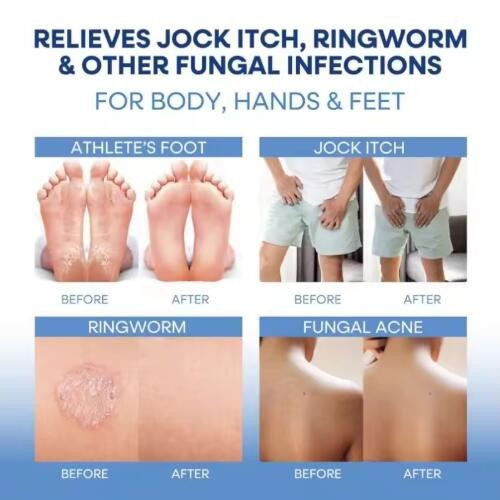 Custom Antibacterial Soap For Foot Odor